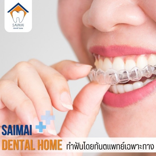 จัดฟันแบบใส สายไหม